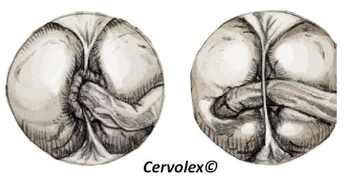 Cervolex  - hentai foundry page 6 full